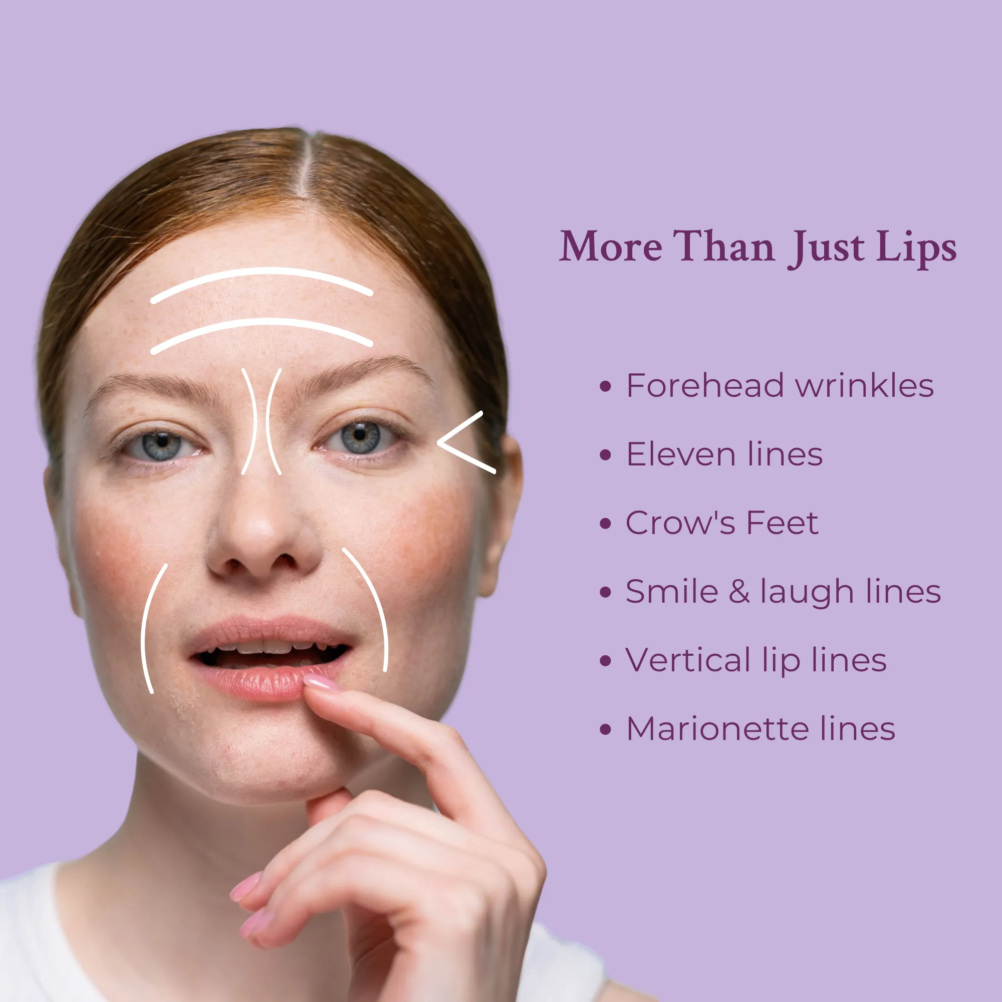 Ageless Lip & Line Filler by PRAI Beauty